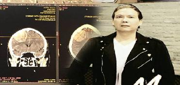 'โดม มาร์ติน'นักร้องร็อกสุดช็อก พบ'เนื้องอก'ในสมอง! 